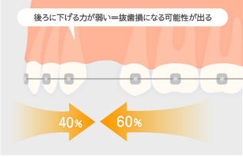 通常の矯正治療イメージ