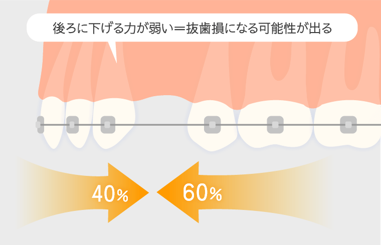 通常の矯正治療イメージ