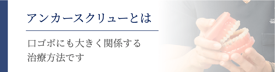 アンカースクリューとは