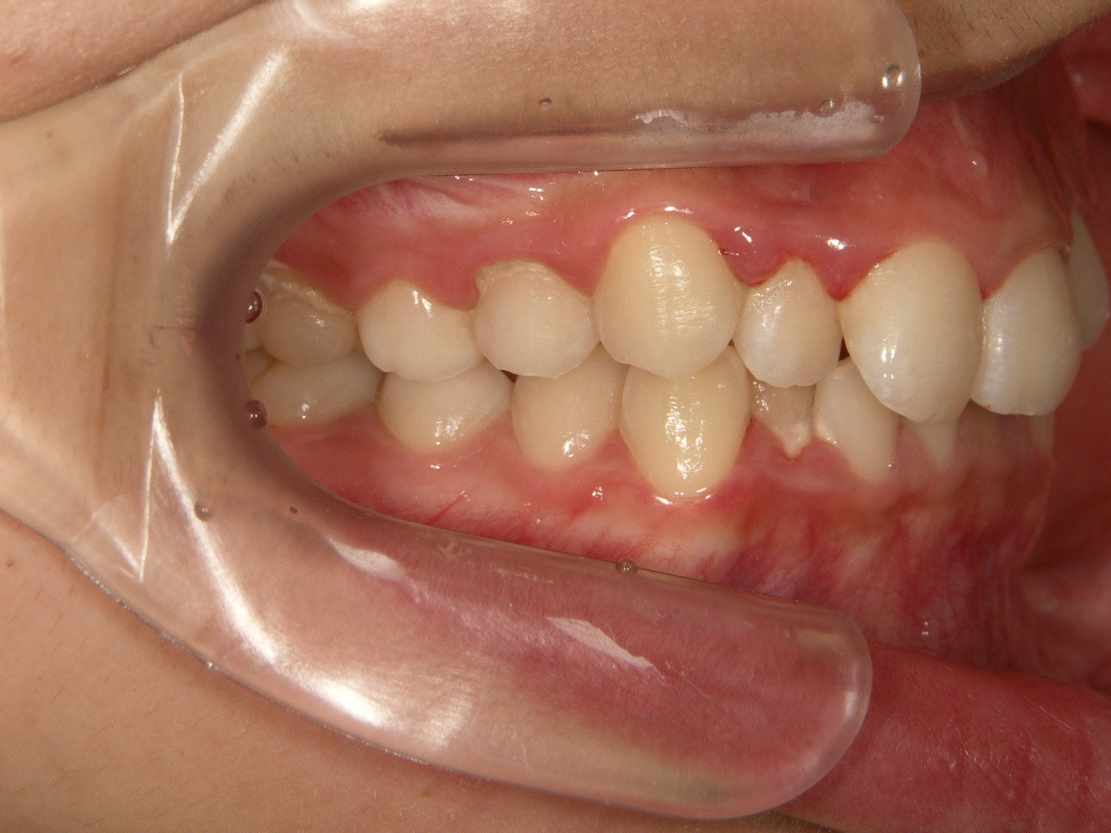 在宅治療の選択肢についてはどうですか?