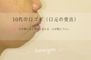 10代の口ゴボ